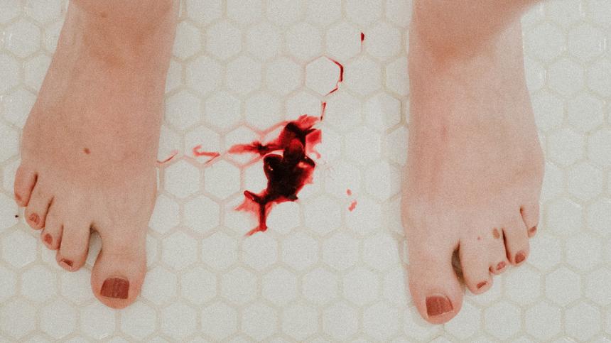 Füße & Blutfleck