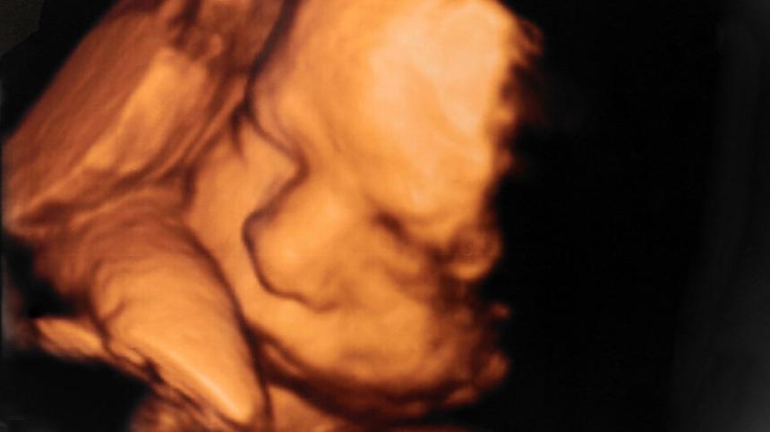 3D-Ultraschall von einem Baby
