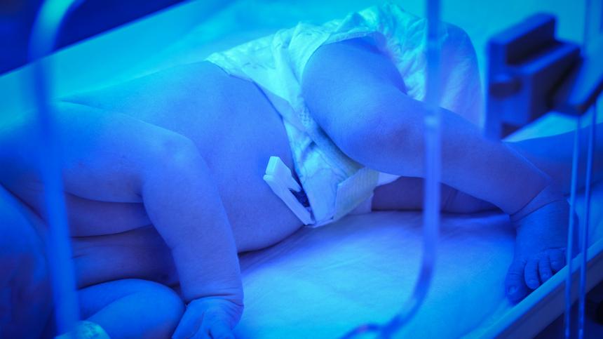 Ein Baby liegt unter blauem Licht