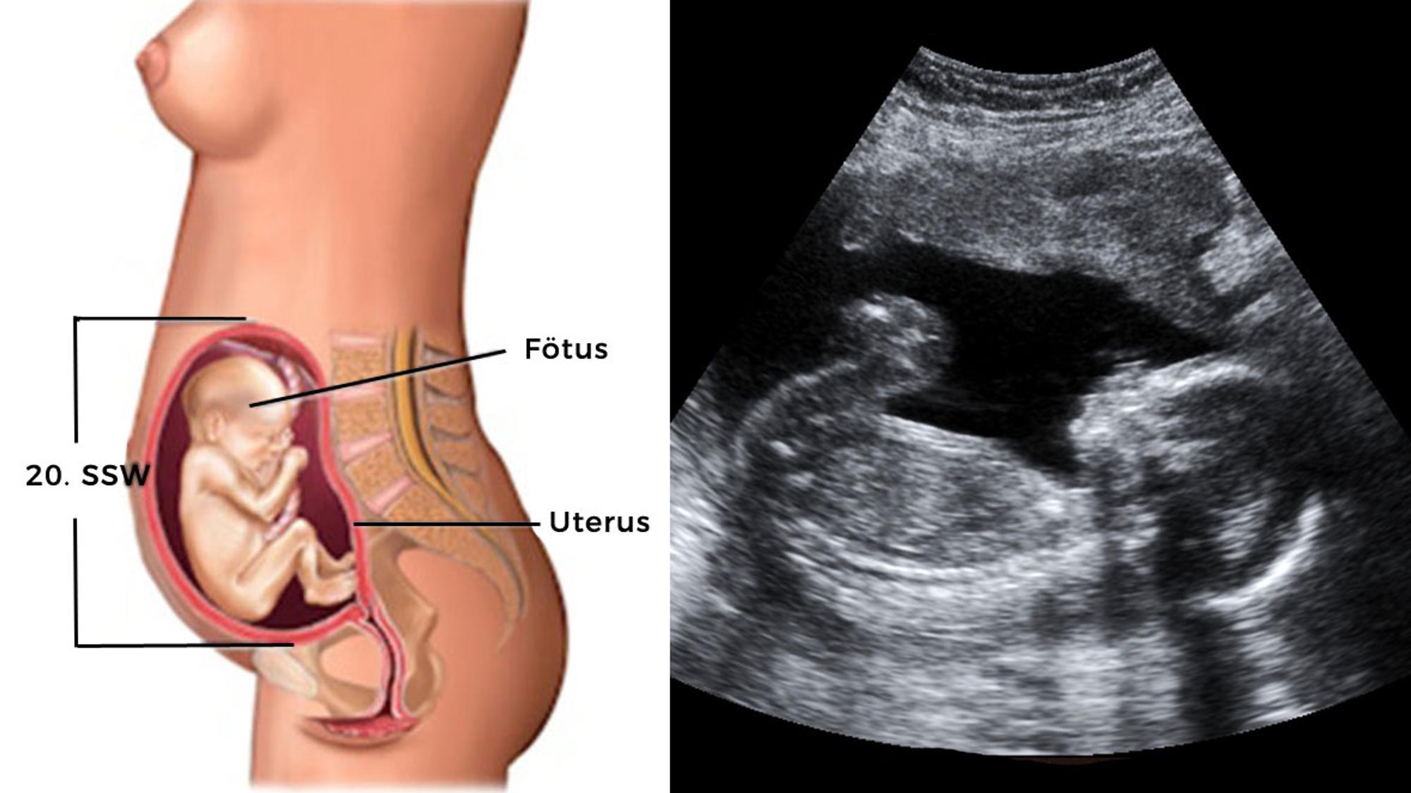 3 monat schwanger Schwangerschaftskalender 3.