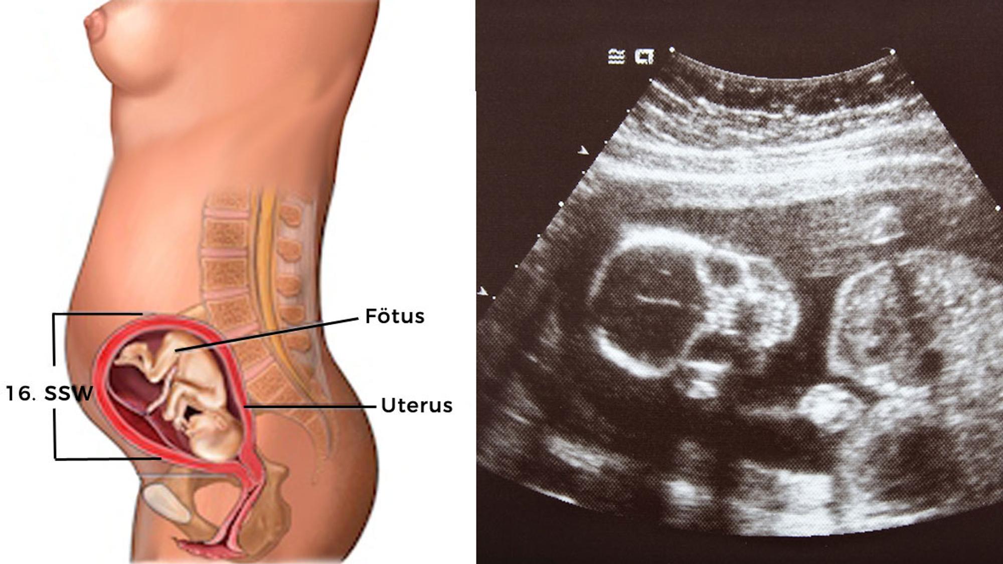 Embryo Entwicklung 4. Monat
