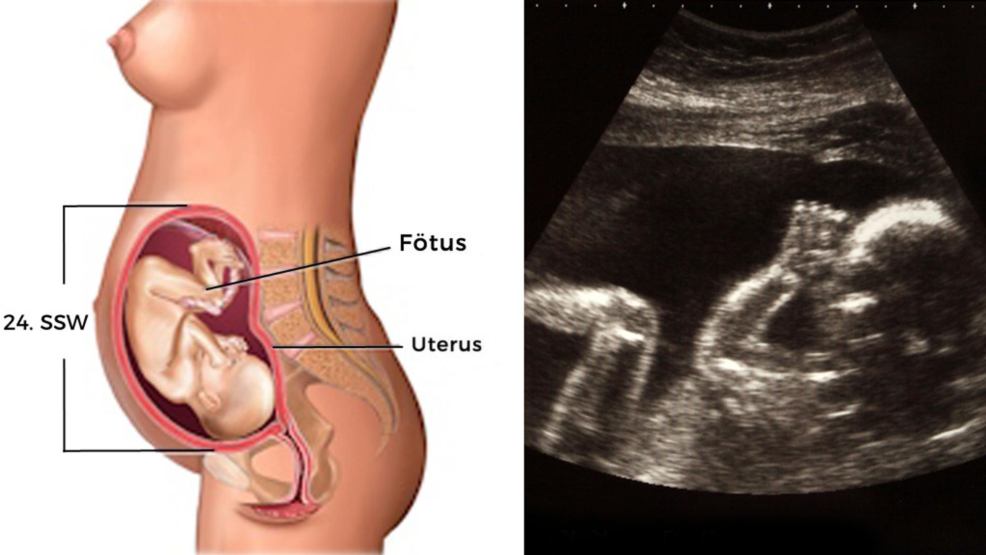 Embryo Entwicklung 6. Monat: SSW 24
