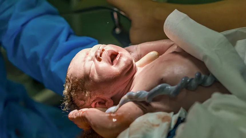 Nabelschnur: Baby kurz nach der Geburt