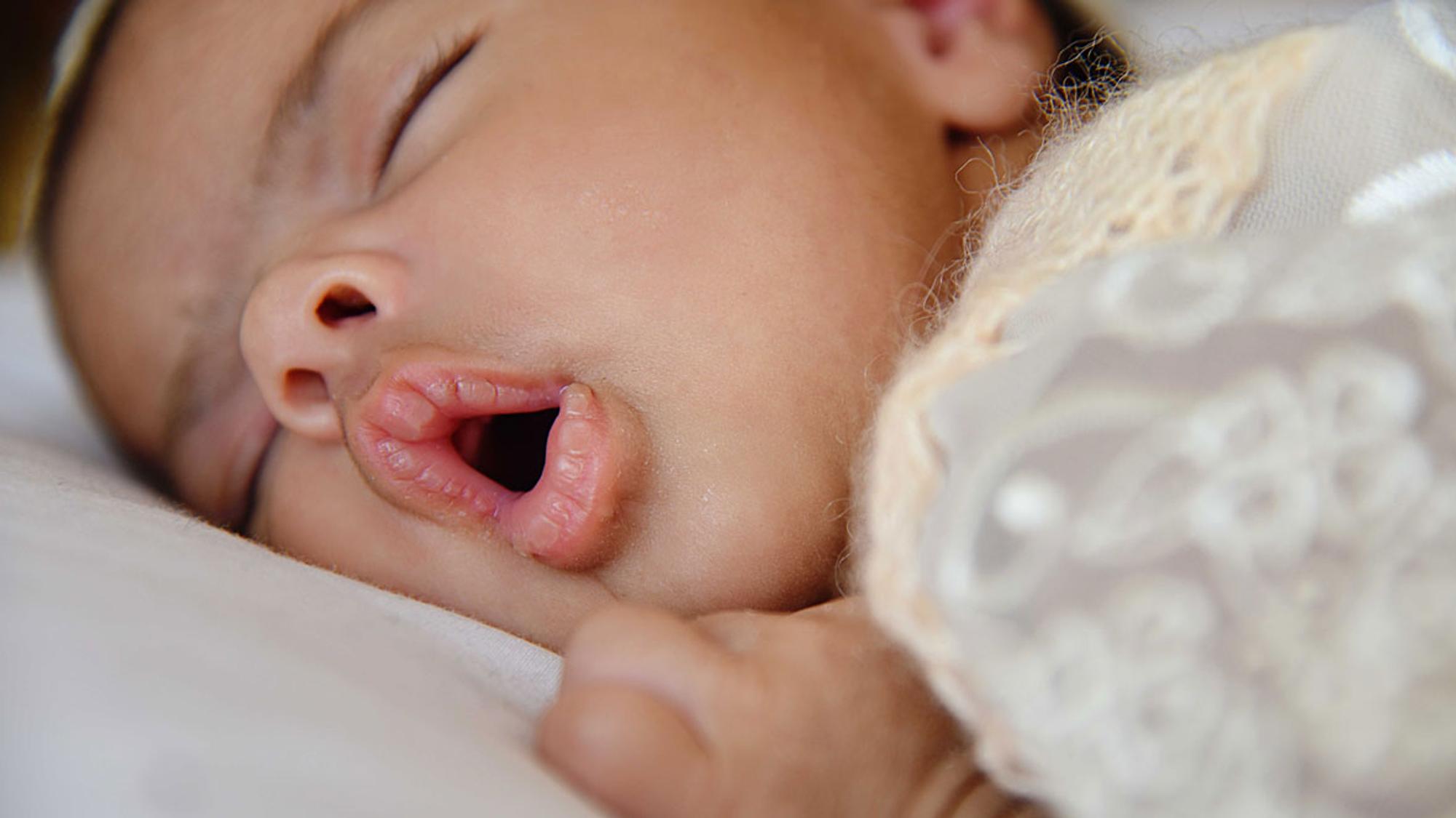 Nasensauger-Staubsauger  Hilfe bei verstopften Baby-Nasen
