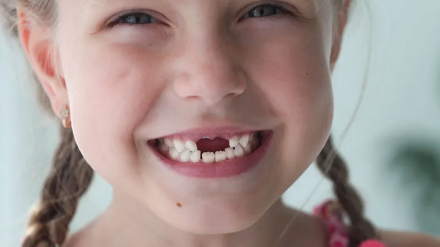 Wackelzahn: Kind mit Zahnlücke