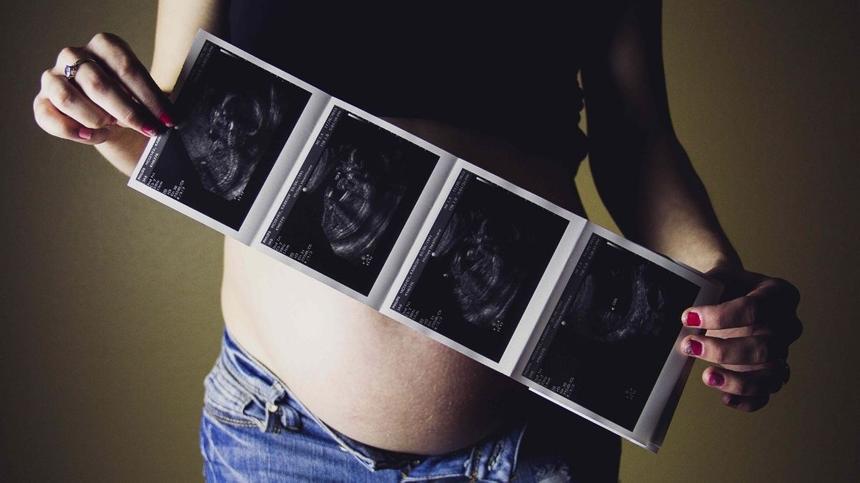 Schwangere Frau hält vier Ultraschallbilder vor ihren Babybauch