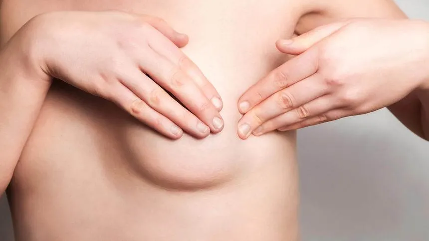 Zysten in der Brust: Frau tastet ihre Brust auf Brustzysten ab