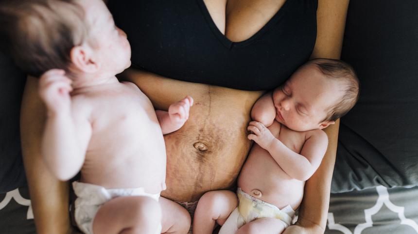 Mutter hält zwei Neugeborene im Arm