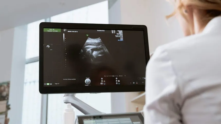 Frauenärztin schaut in Bildschirm während Ultraschall-Untersuchung