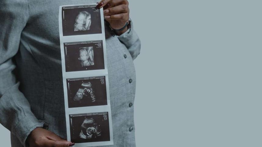 Symbolbild: Mama hält sich Ultraschallbilder vor den Bauch