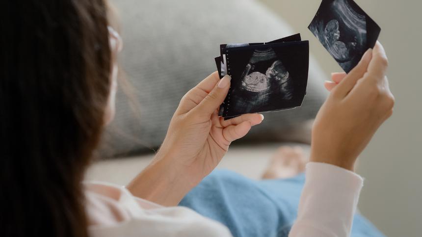 Frau hält Ultraschallbilder eines Babys in der Hand