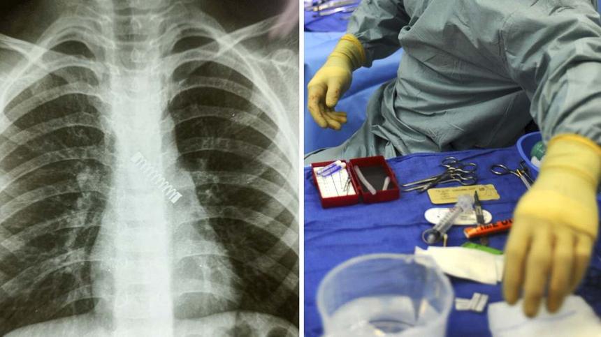 Röntgenbild und Bild aus einem OP-Saal
