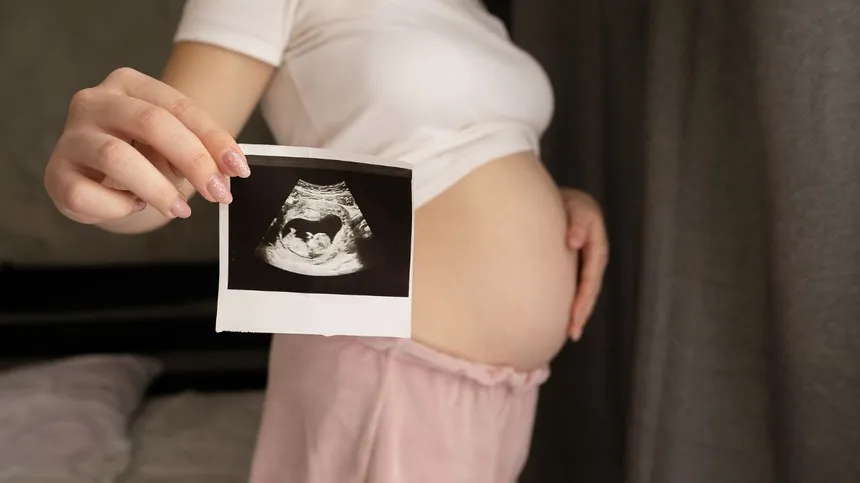Schwangere Frau mit Ultraschallbild ihres Babys