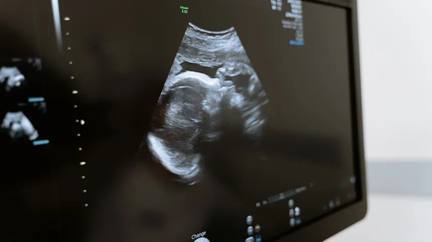 Bild von einem Baby im Ultraschall