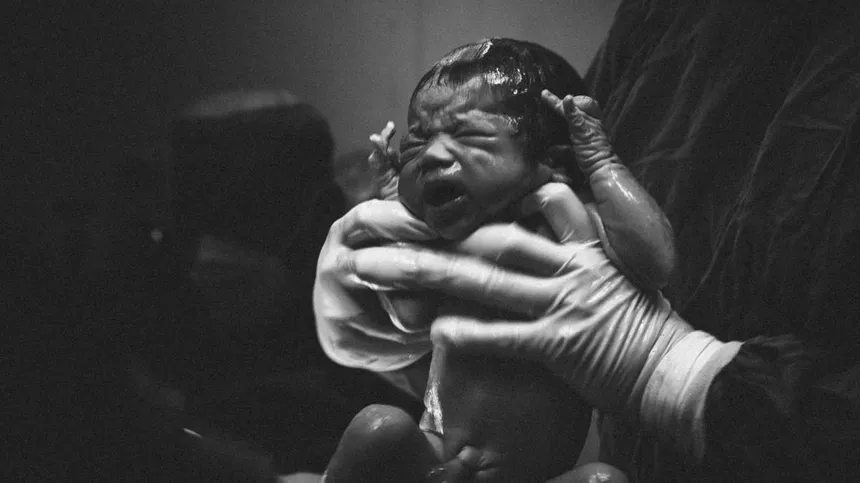 Neuer Geburts-Trend: Mamas ziehen Kaiserschnitt-Babys selbst aus ihrem Bauch