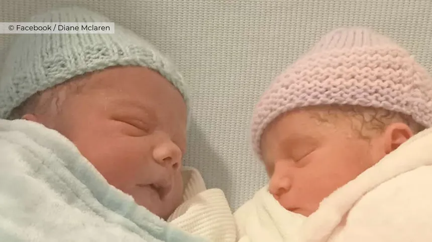 Zwillinge kommen gleichzeitig zur Welt: seltene Geburt verblüfft Ärzte